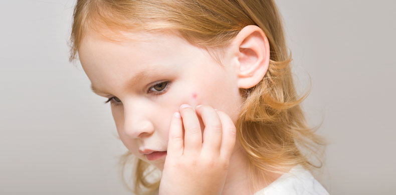 Common Skin Conditions Among Babies and Children