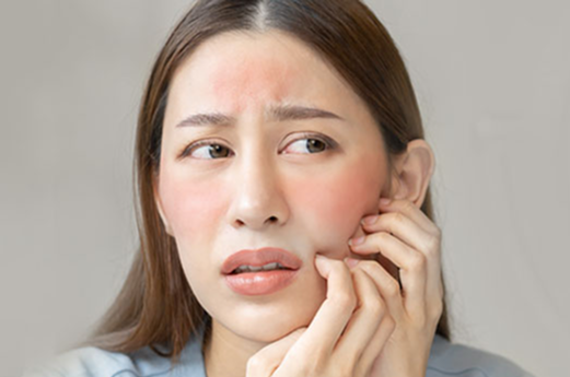 Sensitive and Red Skin